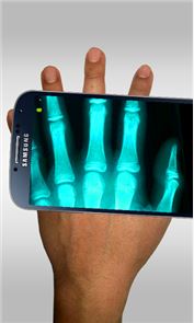 Xray Scanner Prank image