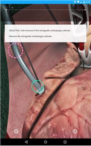Cirugía táctil - Aplicación de imagen médica