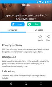 Cirugía táctil - Aplicación de imagen médica