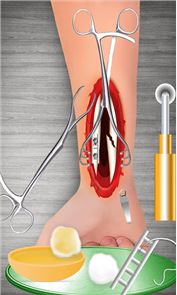 imagem Cirurgia óssea Doctor pulso