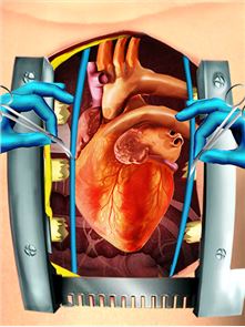 Open Heart Surgery Simulator image