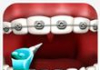 Braces Surgery Simulator