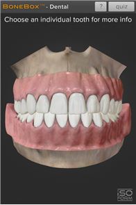 BoneBox ™ - Imagen Dental Lite